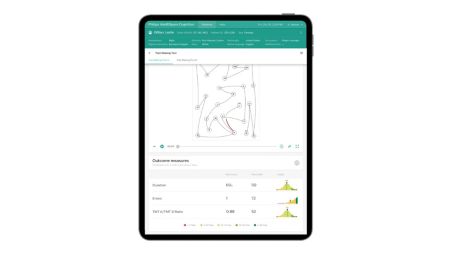 Normed  by Philips for current US demographic