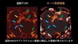 case 87
卵巣腫瘍の診断②