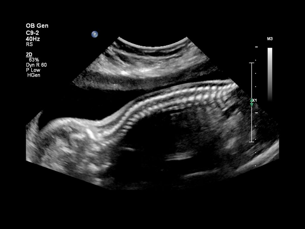 Obstetric image from the Affiniti 70