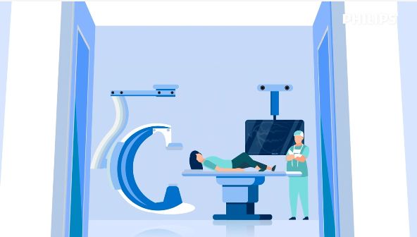 Dynamic Coronary Roadmap – Animatievideo