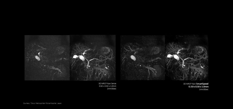 SmartSpeed Abdomen