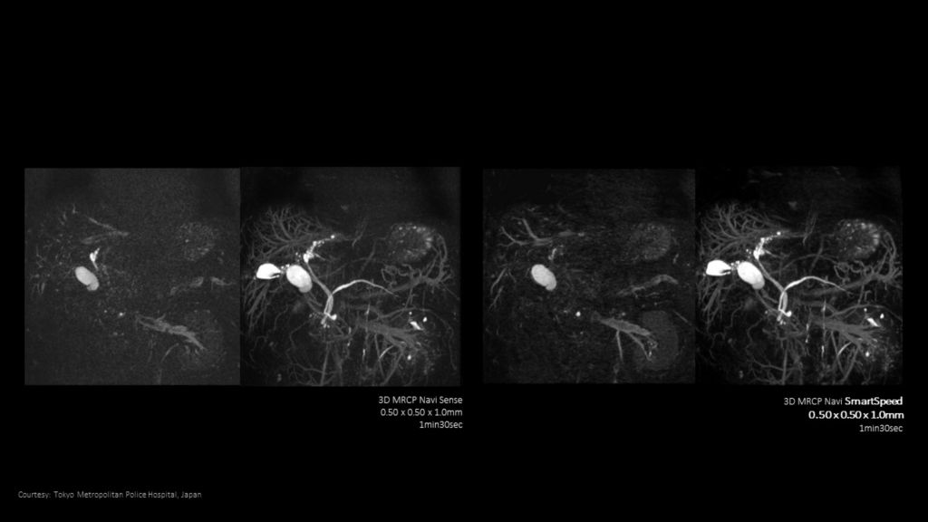 SmartSpeed Abdomen