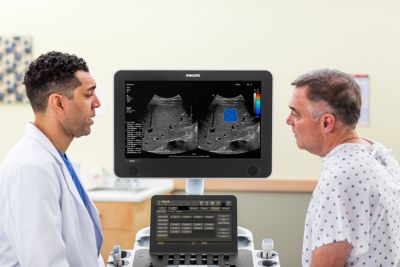 Shear wave elastografie met het Philips EPIQ ElastQ echografie­systeem