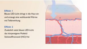 Wohltuende Wirkung: Wärme und körpereigene Prozesse