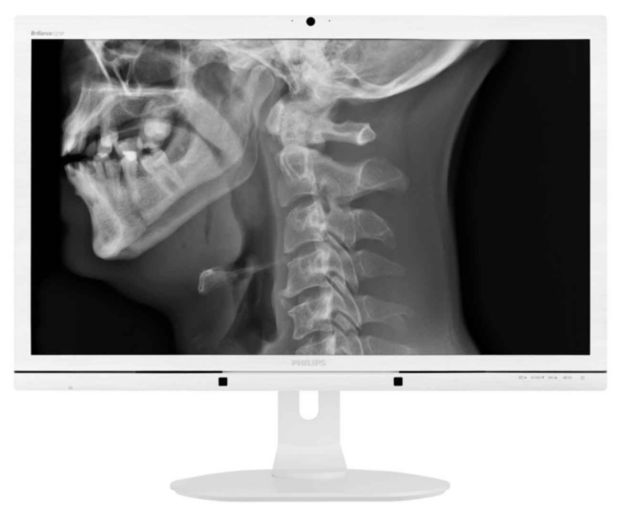 Brilliance LCD monitor with Clinical D-image