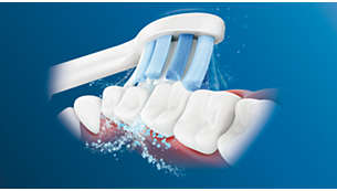 Philips Sonicare -hammasharjan edistynyt Sonic-tekniikka