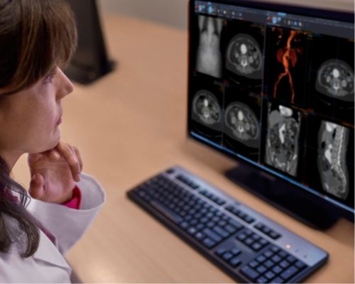 Oplossing voor radiologie-informatica