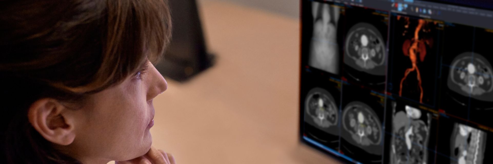 Radiology informatics