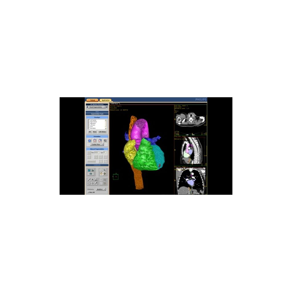 Automatic segmentation 1