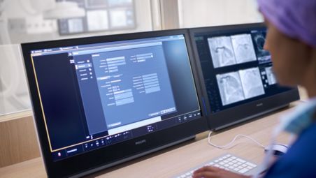 Simplifique la configuraci&oacute;n y el funcionamiento