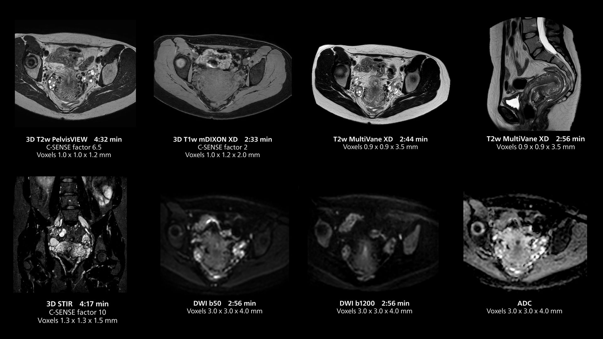 Female pelvis imaging using MR 5300