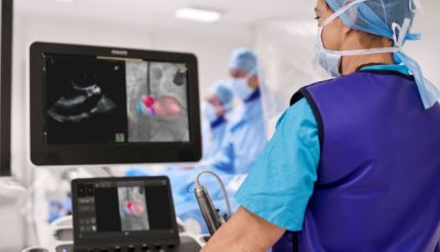 Clinician using Philips EPIQ CVx with EchoNavigator during image guided cardiac procedure
