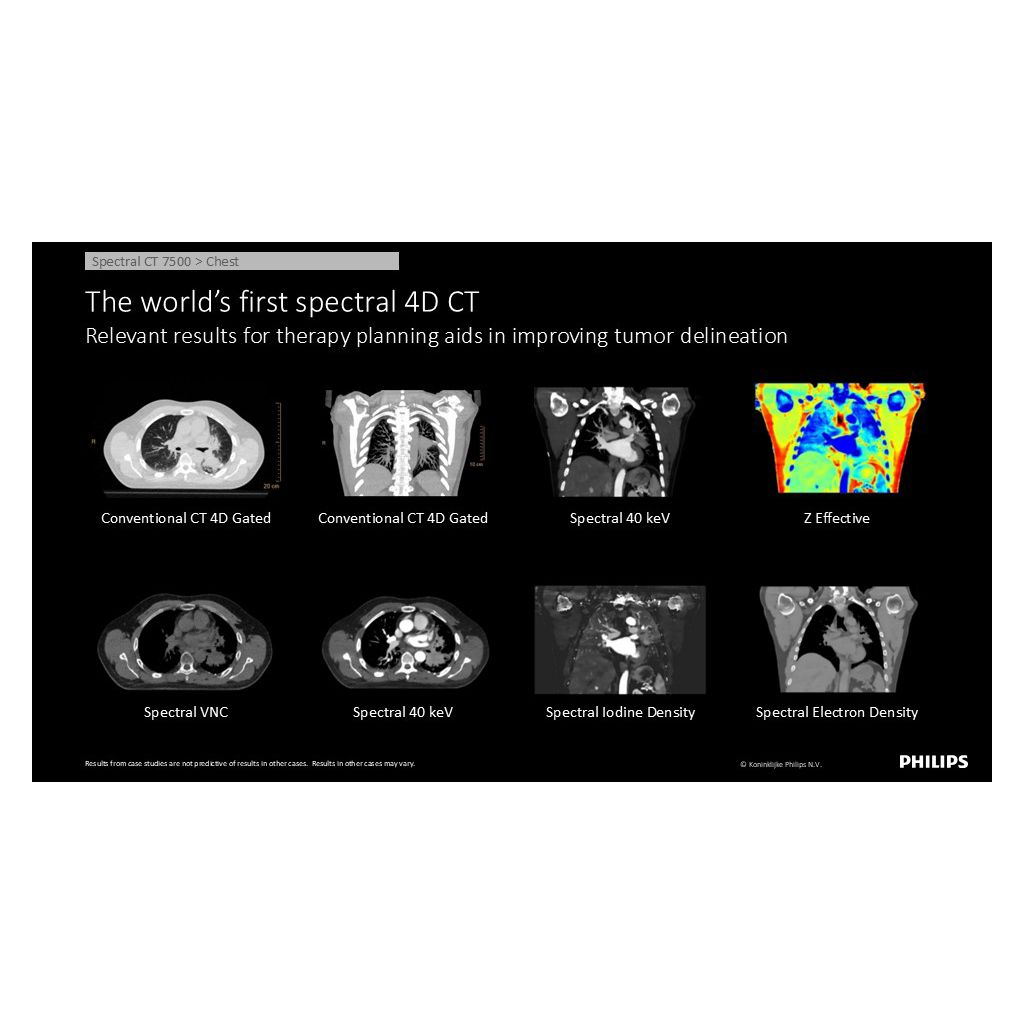 World’s-first spectral 4D CT