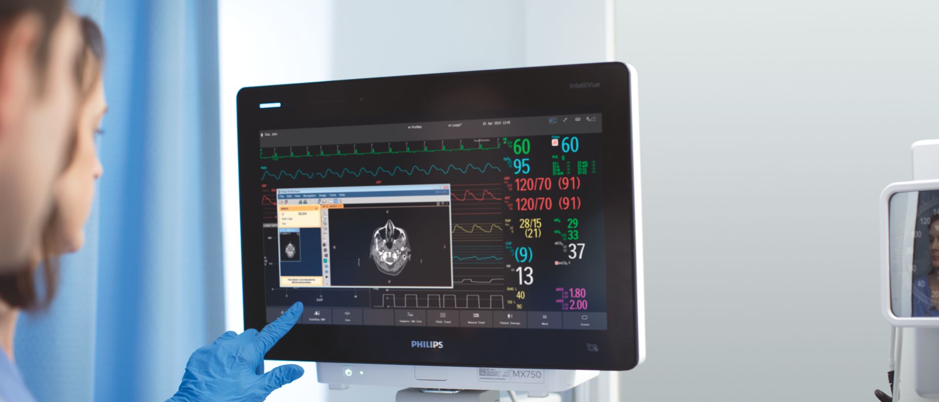 Clinical decision support - Philips