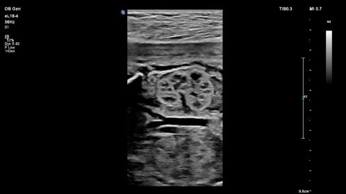 Fetal Kidney-eL18-4