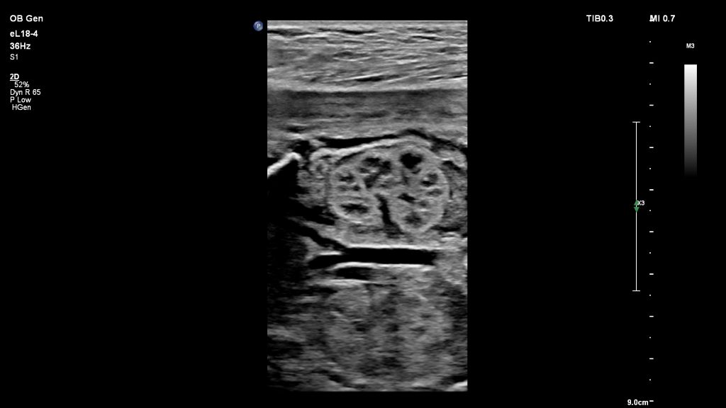 Fetal Kidney-eL18-4