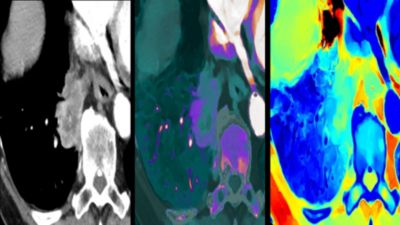 Conventional and spectral CT scan image