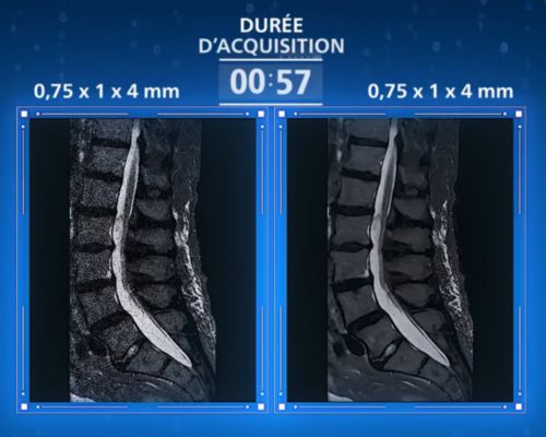 Image SmartSpeed Precise illustrant la vitesse