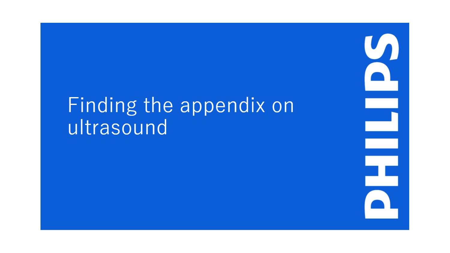 Finding the appendix on ultrasound