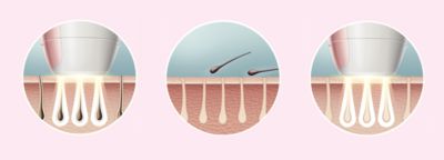 Enjoy smooth skin every day