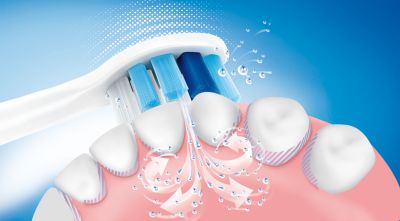 Technologie brevetée Philips Sonicare