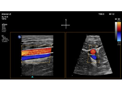 Ultrasound web xMatrix