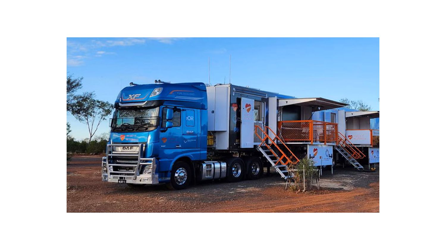 Project Eddy mobile screening truck 
