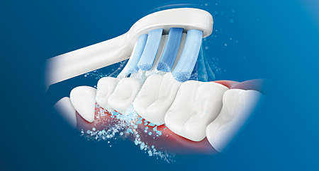 3 Series gum health ソニッケアー ガムヘルス プロフェッショナル HX6681/06 | Sonicare 3 Series gum health ソニッケアー ガムヘルス プロフェッショナル HX6681/06 | Sonicare