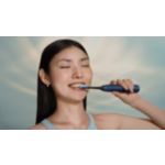 自信が湧いてくる自然な白い歯をこの一本から