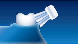 Les tests cliniques ont montré que l'utilisation de cette brosse à dents est douce pour les gencives.