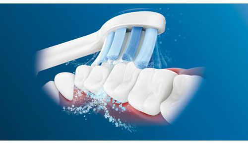 Philips Sonicare's advanced sonic technology