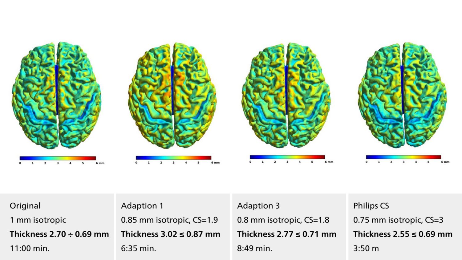 Voxel based morphometry