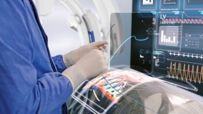 Minimally invasive procedure guided by real-time Philips imaging