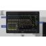 Continuous monitoring in perioperative care with the IntelliVue MX850 thumbnail