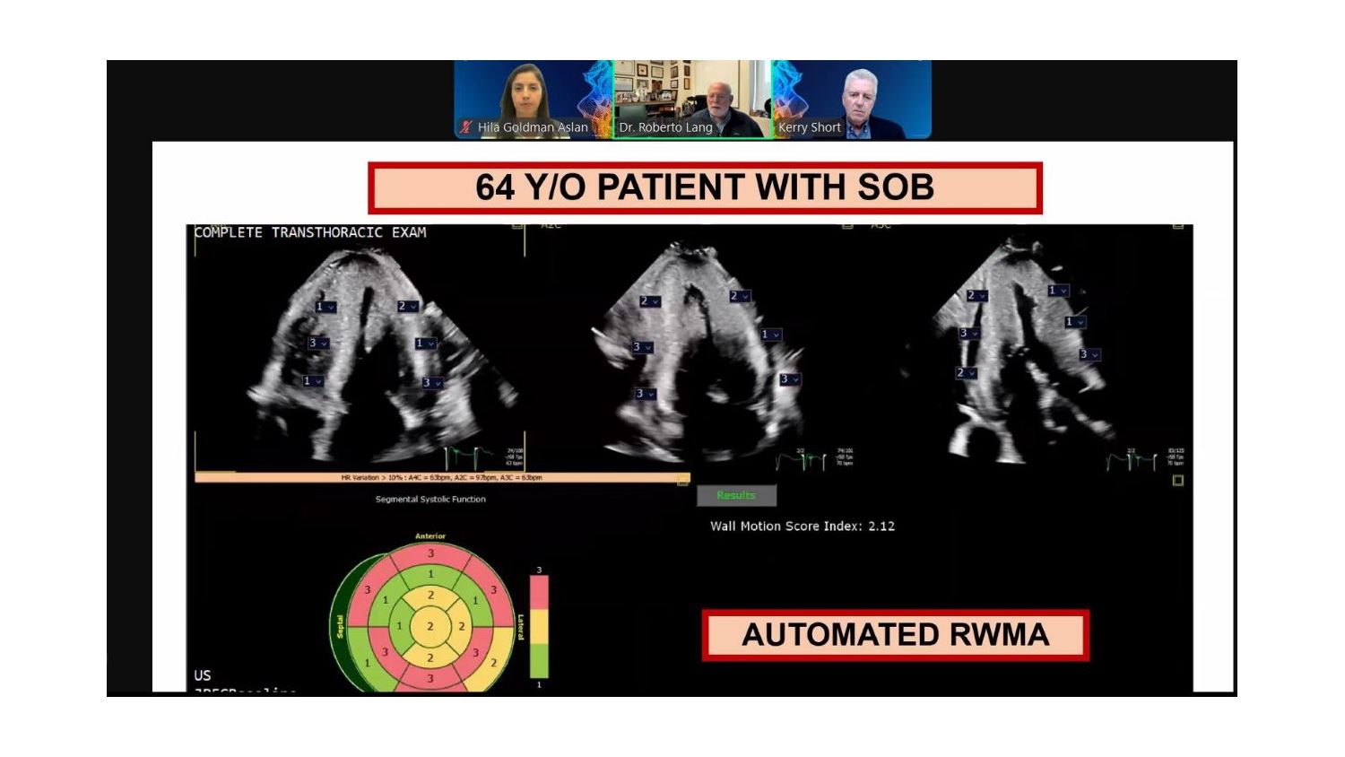 64 Y/O patient with SOB