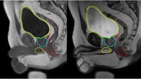 Create accurate*** contours with little to no user interaction