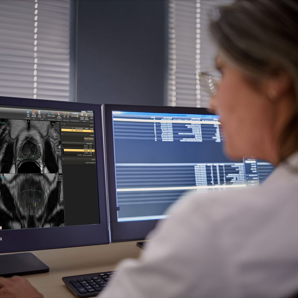 dynacad prostate