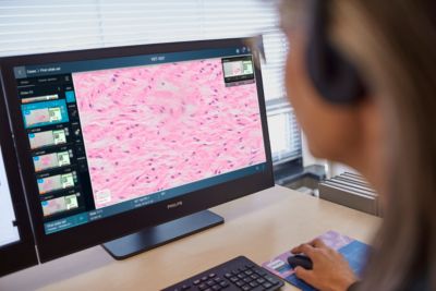 Medisch specialist bekijkt een digitaal pathologiepreparaat op een computermonitor
