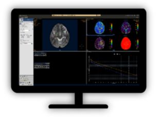 MR Advanced Diffusion Analysis​ Computed diffusion weighted images at a b-value of choice​