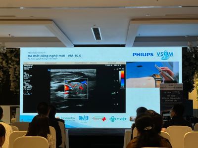 Nicole McDonal trình diễn với đầu dò mL26-8