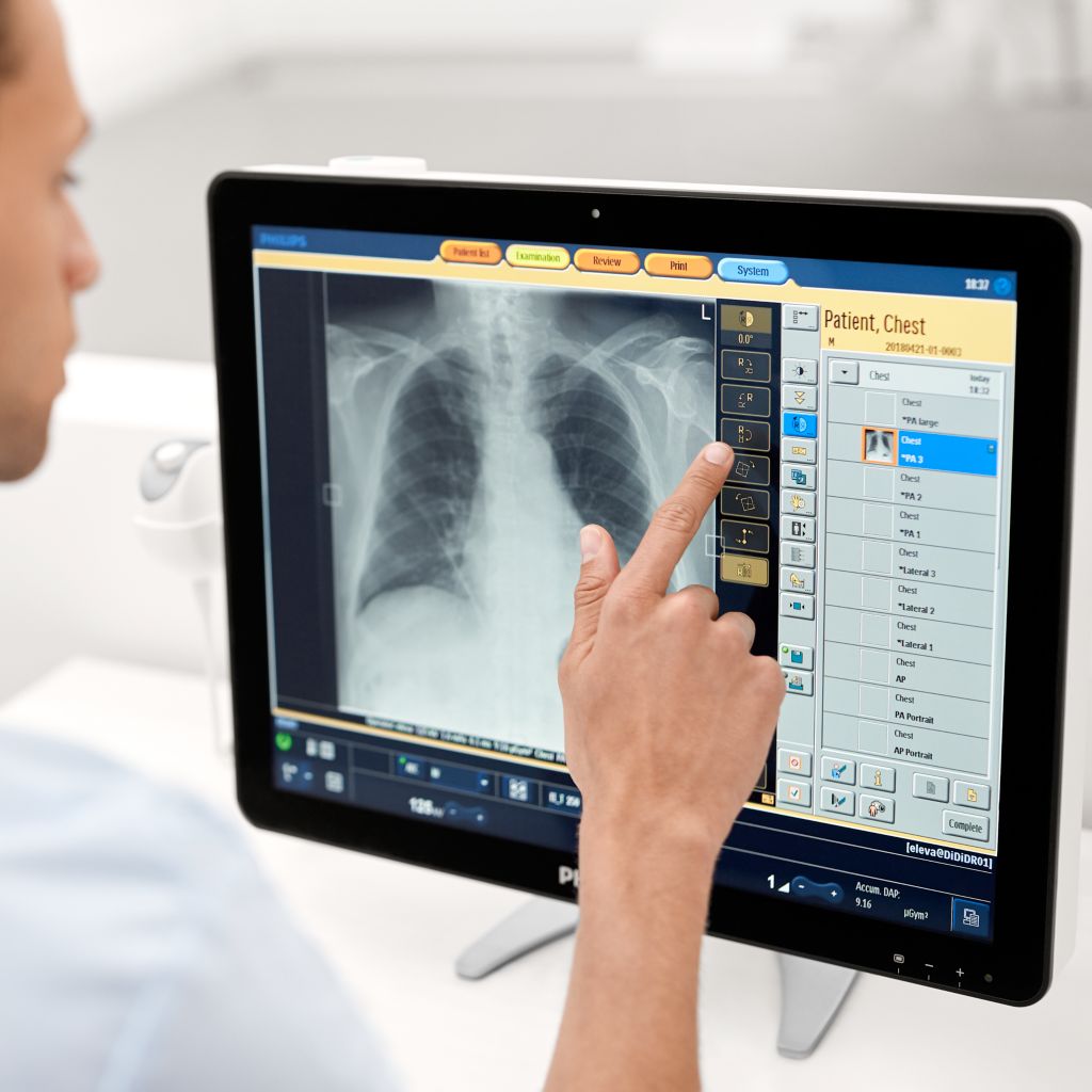 DigitalDiagnost C90, application, tech, workspot, ELEVA operation