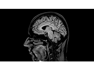 BrainVIEW 3D Application clinique IRM