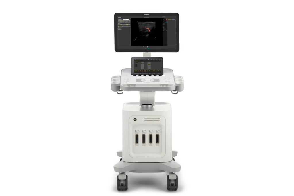Philips 3300 front photo bending