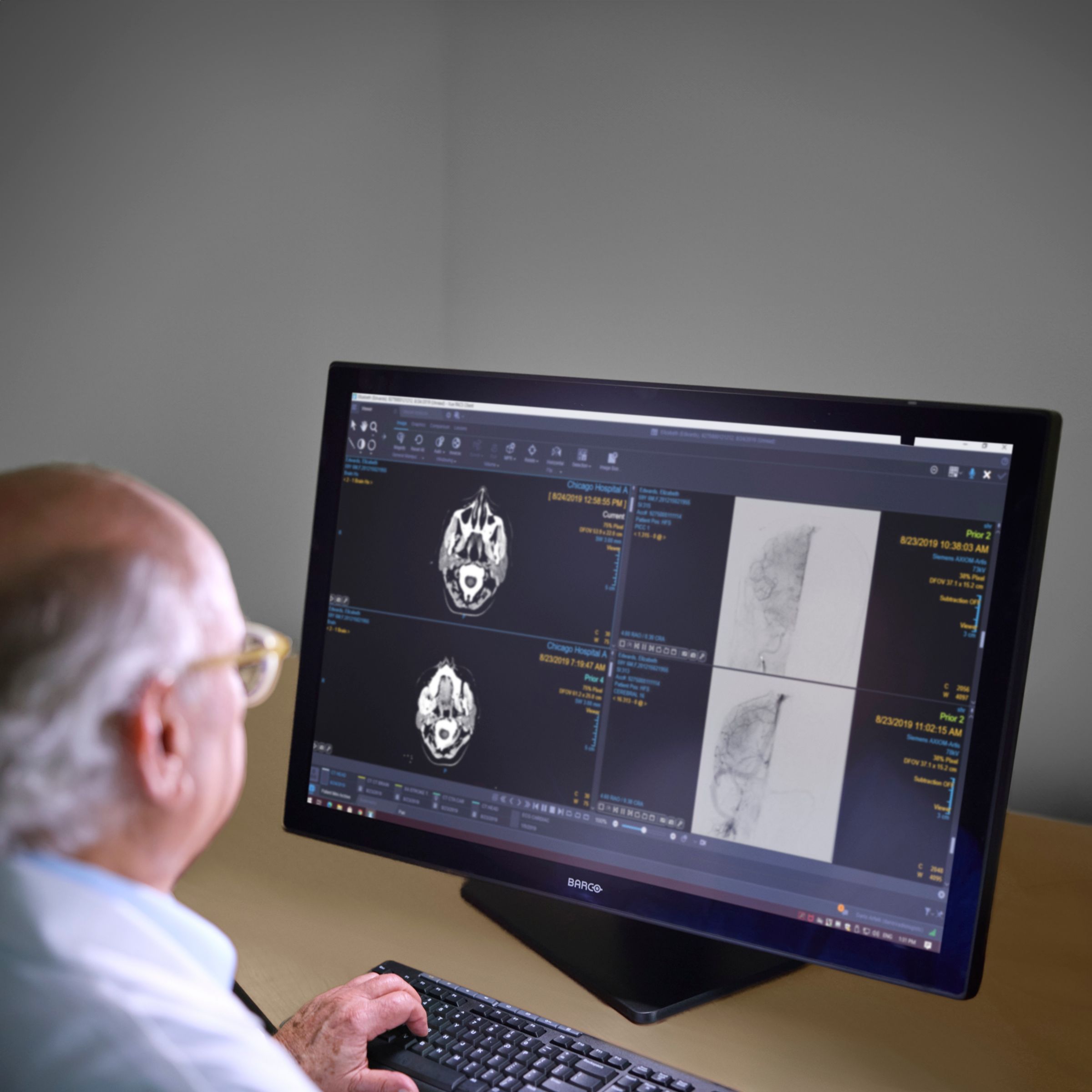 Breast imaging Brochure