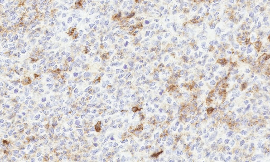 Clinical image digital pathology