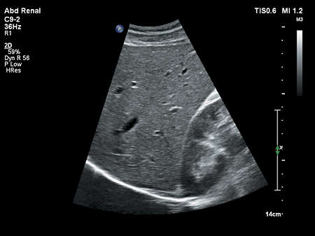 C9-2 Abdomen Renal