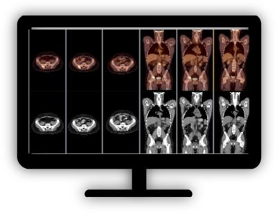 Philips - NM Mirada Viewer PET/CT and NM viewing and quantification