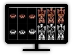 NM Mirada Viewer PET/CT and NM viewing and quantification