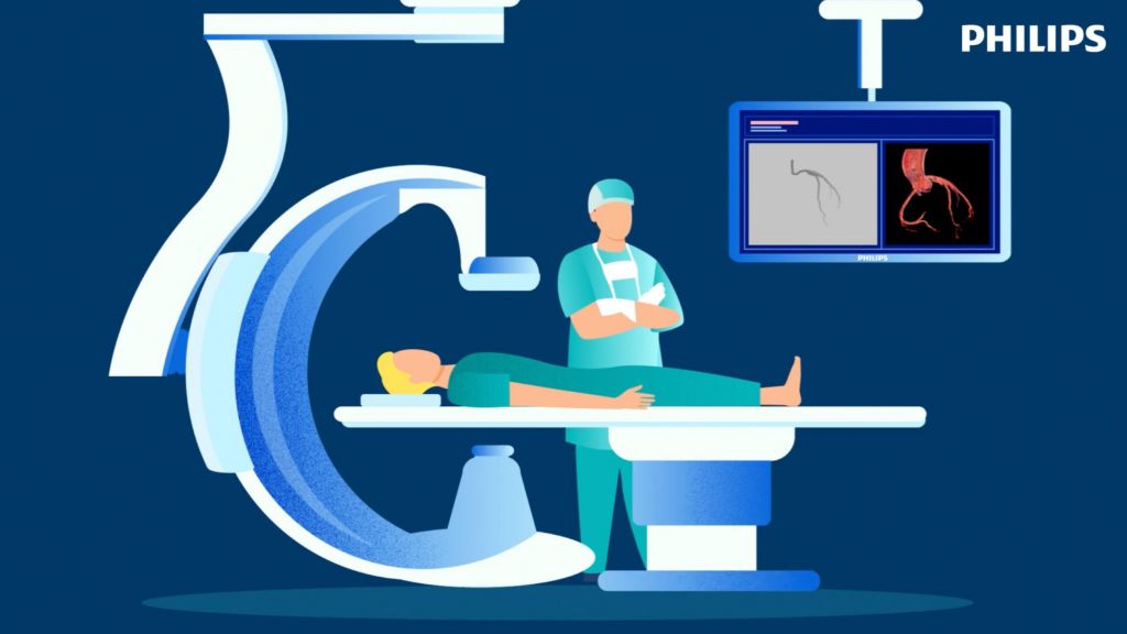 C-arm Azurion cathlab explainer animation