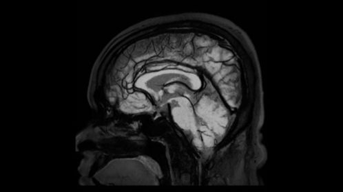 3D BrainView BB MSDE